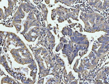 Anti-BIN1 Antibody