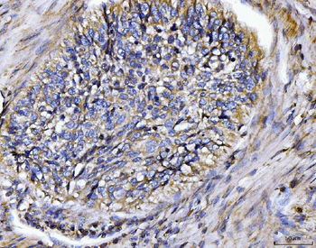 Anti-BIN1 Antibody