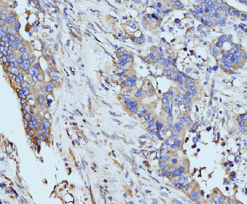 Anti-BZW2 Antibody