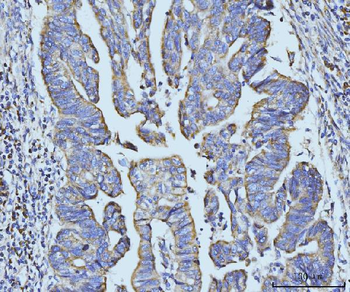 Anti-BZW2 Antibody