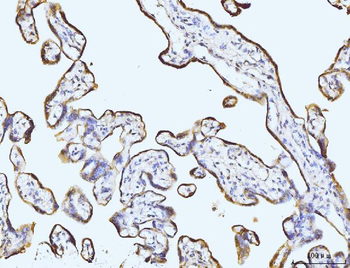 Anti-BZW2 Antibody