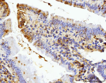 Anti-BZW2 Antibody