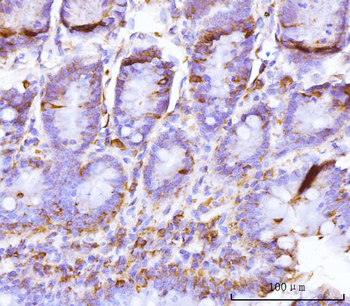 Anti-BZW2 Antibody