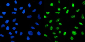 Anti-CRTC3 Antibody