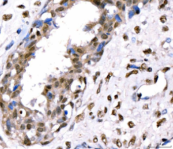Anti-CRTC3 Antibody