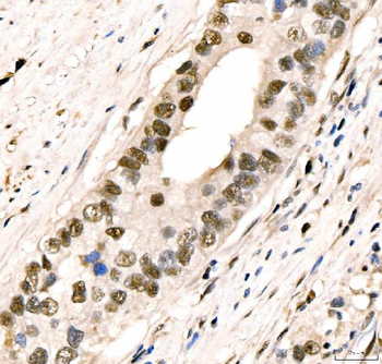 Anti-CRTC3 Antibody