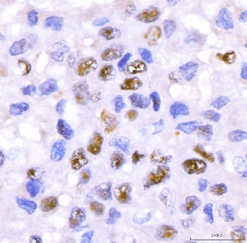 Anti-CRTC3 Antibody