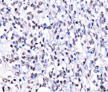 Anti-CRTC3 Antibody