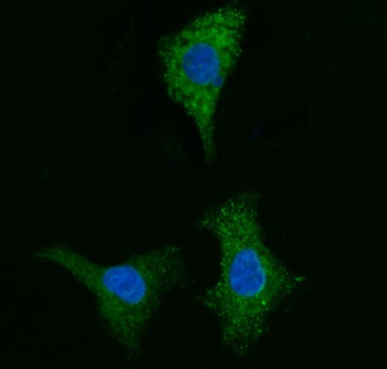 Anti-CYB5B Antibody