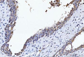 Anti-CYB5B Antibody