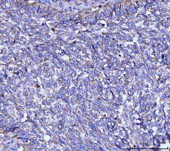 Anti-CYB5B Antibody