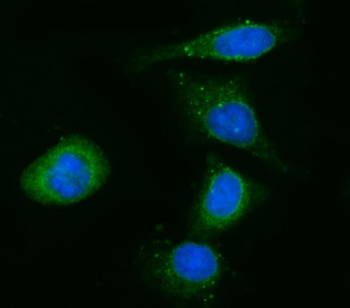 Anti-CYB5R3 Antibody