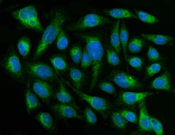 Anti-CYB5R3 Antibody