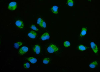 Anti-ECSIT Antibody