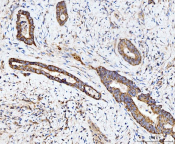 Anti-ECSIT Antibody