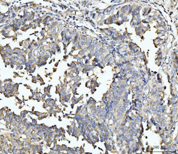 Anti-ECSIT Antibody