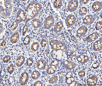 Anti-ECSIT Antibody