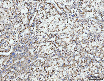 Anti-ECSIT Antibody