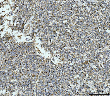 Anti-ECSIT Antibody