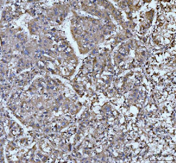 Anti-EDEM3 Antibody