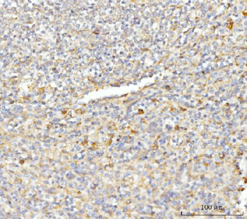 Anti-EIF3E Antibody