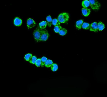 Anti-ETFA Antibody