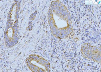 Anti-ETFA Antibody
