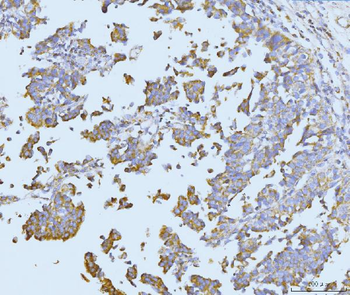 Anti-ETFA Antibody
