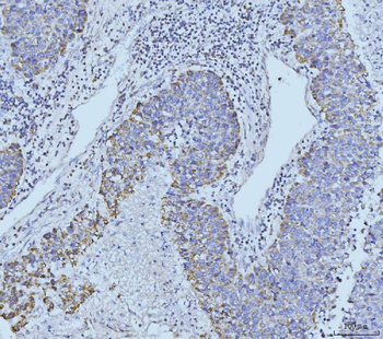 Anti-ETFA Antibody