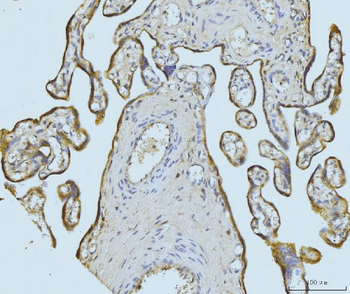 Anti-ETFA Antibody