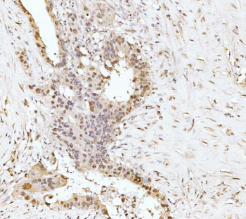Anti-RRP4/EXOSC2 Antibody