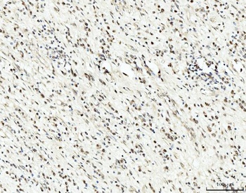 RRP4/EXOSC2 Antibody