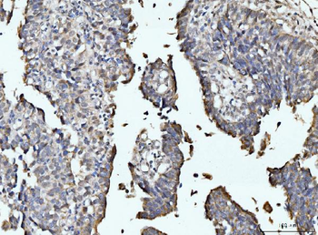 Anti-RRP4/EXOSC2 Antibody