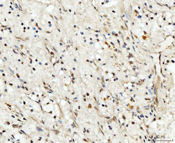 Anti-RRP4/EXOSC2 Antibody
