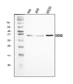 Anti-EXOSC8 Antibody