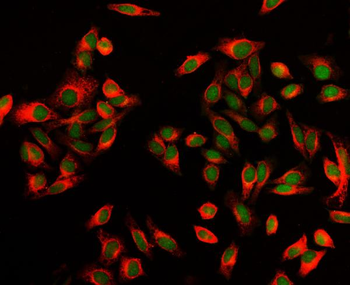 Anti-EXOSC8 Antibody