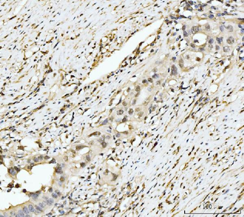 Anti-EXOSC8 Antibody