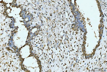 EXOSC8 Antibody