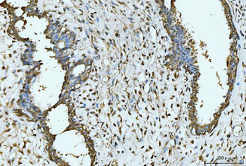 Anti-EXOSC8 Antibody