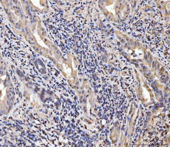 Anti-EXOSC8 Antibody