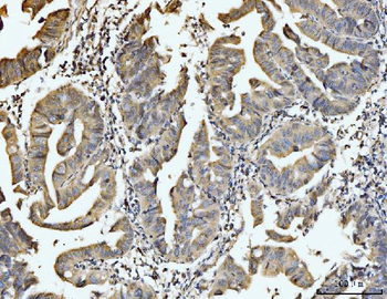 Anti-EXOSC8 Antibody