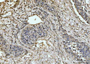Anti-EXOSC8 Antibody