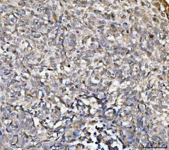 Anti-EXOSC8 Antibody