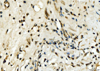 Anti-EXOSC8 Antibody