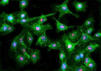 Anti-Fibrillarin/FBL Antibody