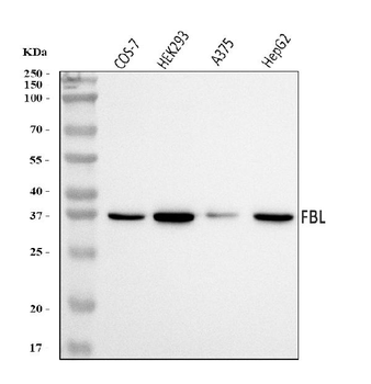 Anti-Fibrillarin/FBL Antibody