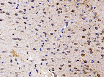 Anti-FKBP135/FKBP15 Antibody