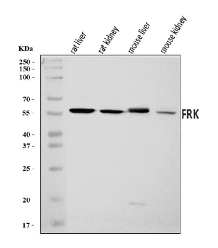 Anti-FRK Antibody
