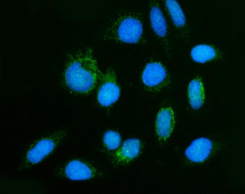 Anti-GHITM Antibody