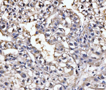 Anti-GHITM Antibody
